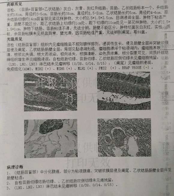 哎，二期c到底该不该化疗。来个懂得给点建议。