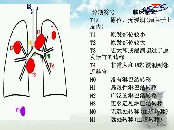 如何判断肿瘤的恶性程度和轻重程度？浅谈肿瘤的分级分期