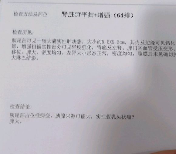 实性假乳头状瘤？请大家帮忙看看，现在整个人十分害怕。