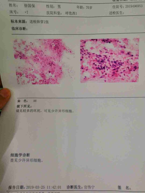 大家帮我看看我爸爸这是晚期吗？