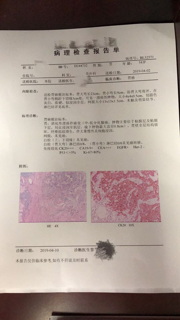 我爸今年54岁，3月22号检查出来胃癌