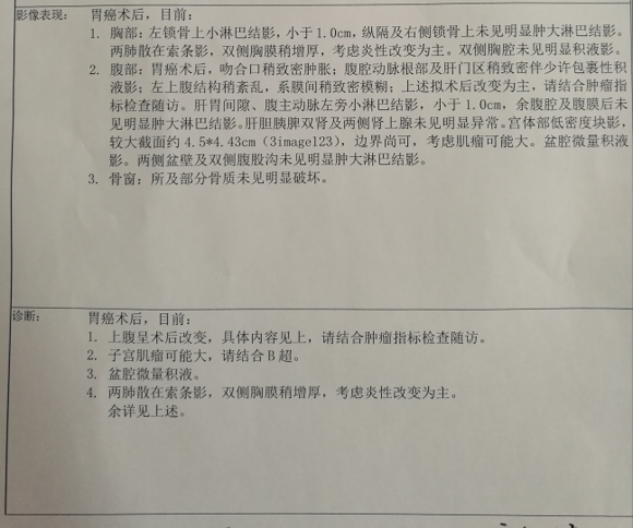 胃癌术后的增强ct报告，麻烦有没有懂的人看看