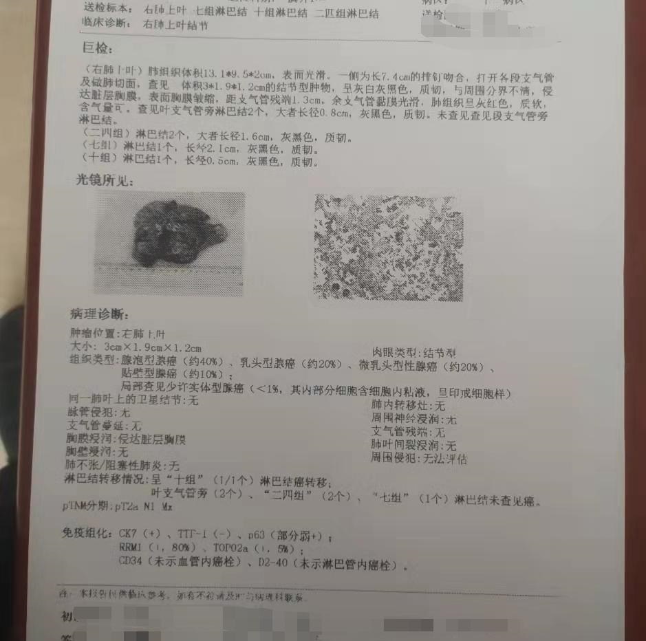 麻烦您帮我看下