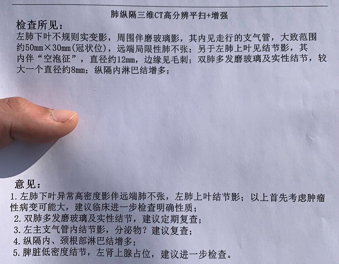 我妈妈前几天在武汉协和医院做的增强ct结果，医生说大概率是肺癌