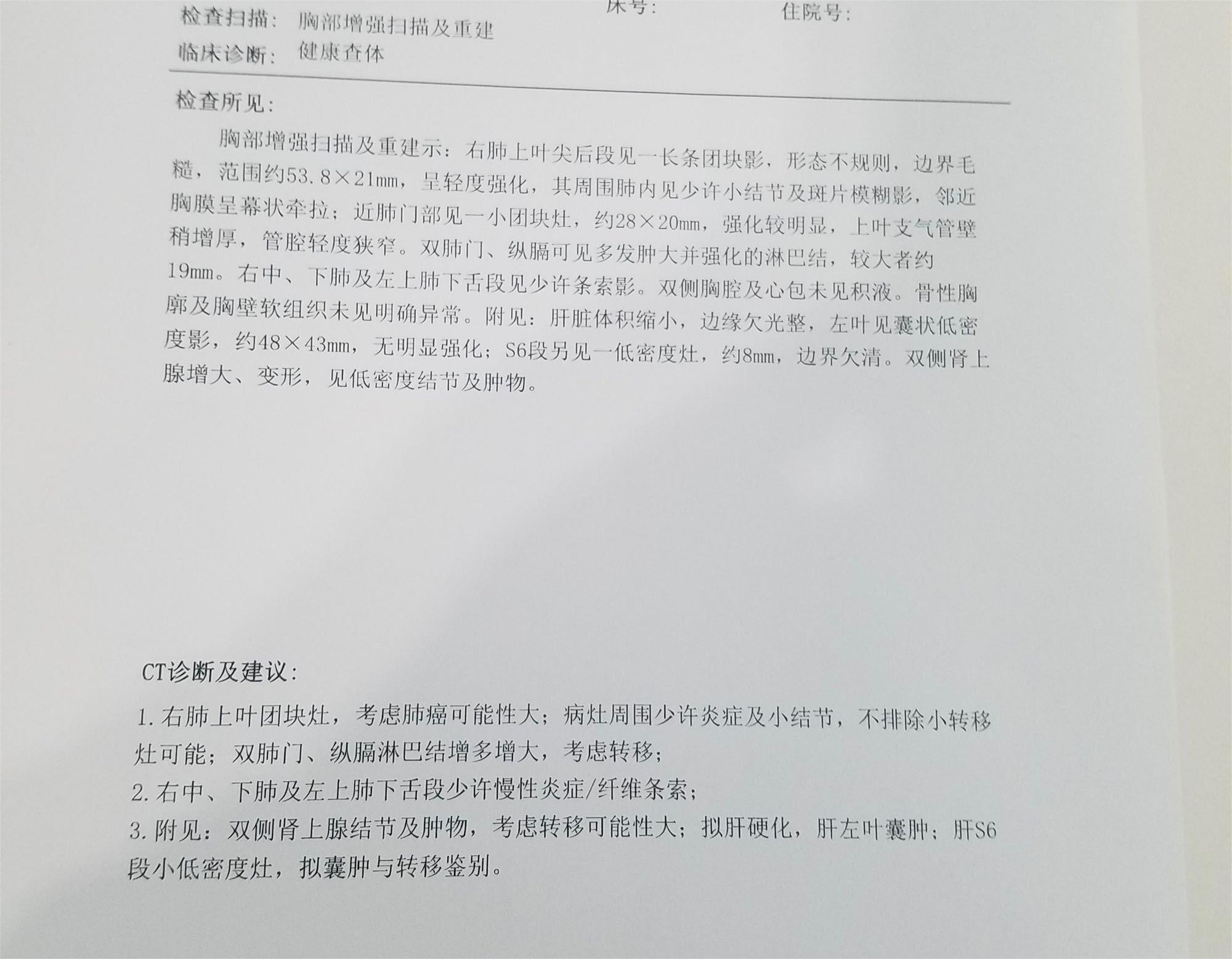 跪求有没有人能告诉我这个有多严重了