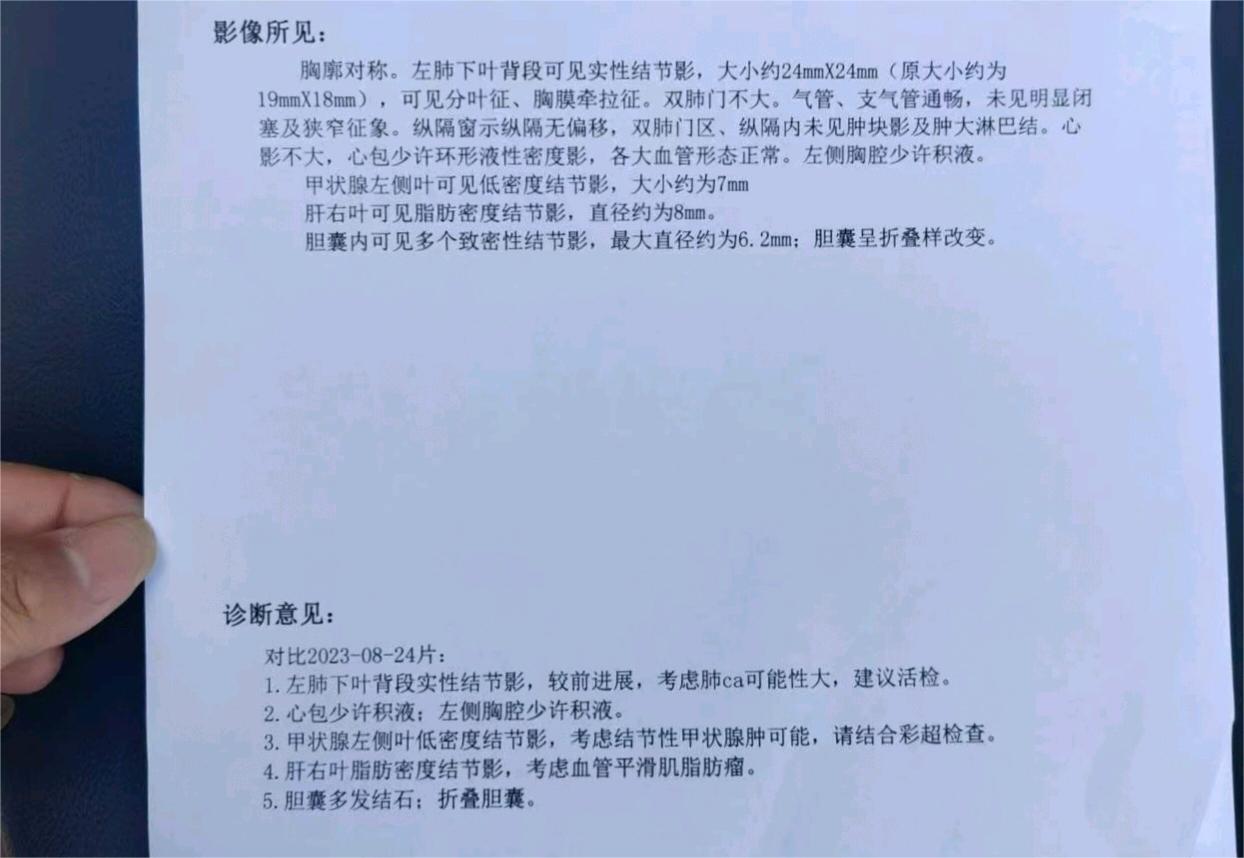 我妈不肯上广州治疗吃了两年多中药的结果